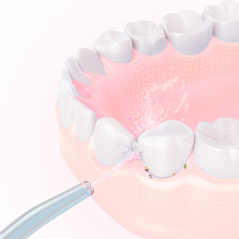 Nozel Pengganti untuk Alat Iri - Oral Irrigator Flosser ulasan dan harga