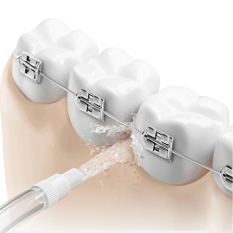 Nozel Asli untuk Semua Xiaomi  - Oral Irrigator Flosser ulasan dan harga